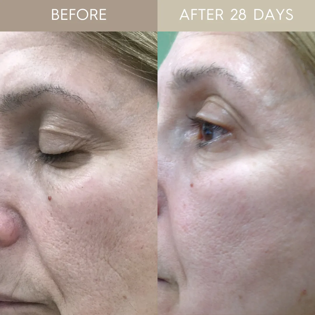 De-Age LED EMS Skin Booster Duo - 20ml x 4